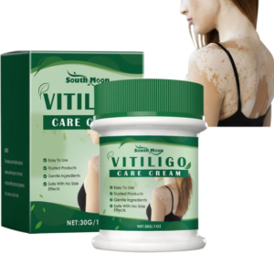 🌿 Vitiligo Herbal Aloe Vera & Mint Care Cream — Buy 1 Get 1 Free! 🌿